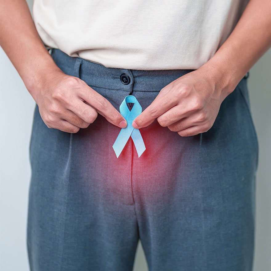 Testicular Cancer Care