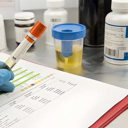 Urine & Stool Tests