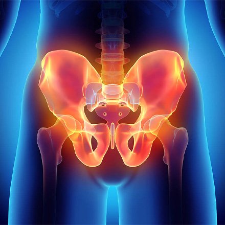 Pelvic Pain Management