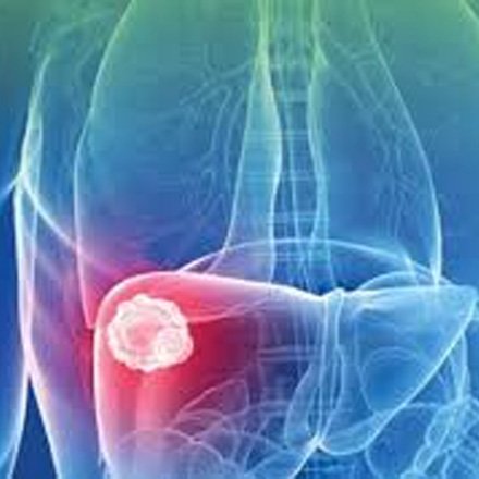 Cancer Diagnosis and Evaluation