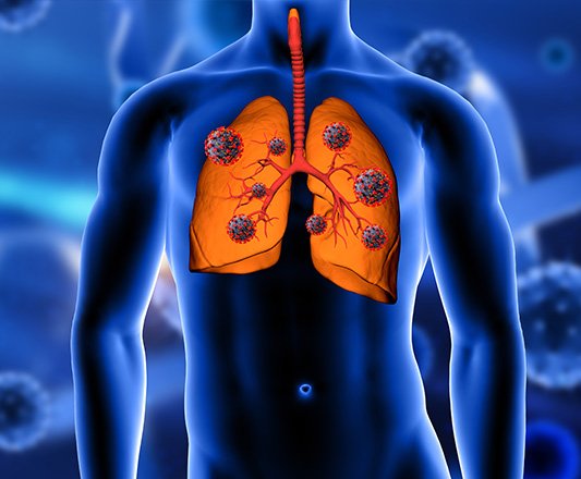 Pulmonology and Lung Care