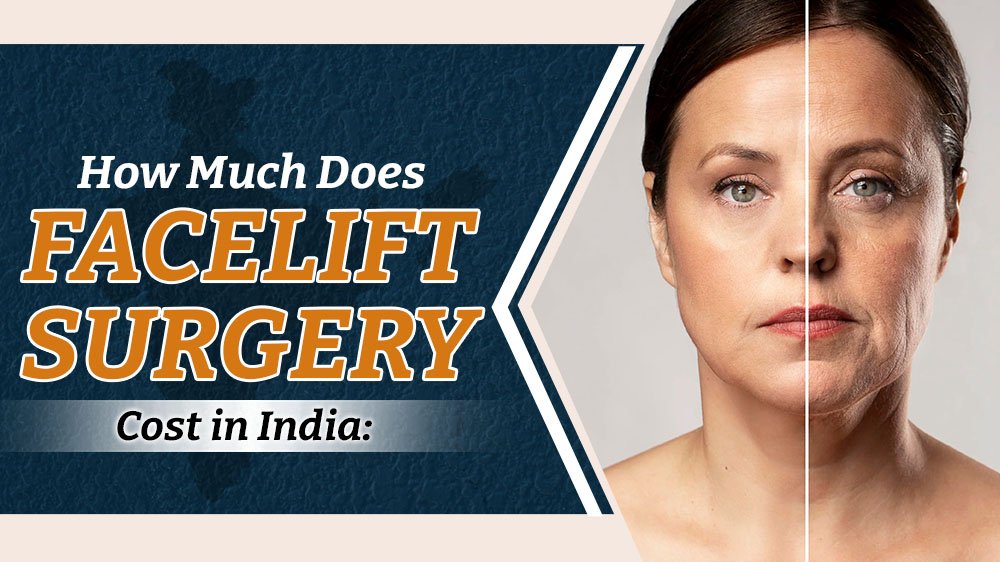  Facelift Surgery Cost in India