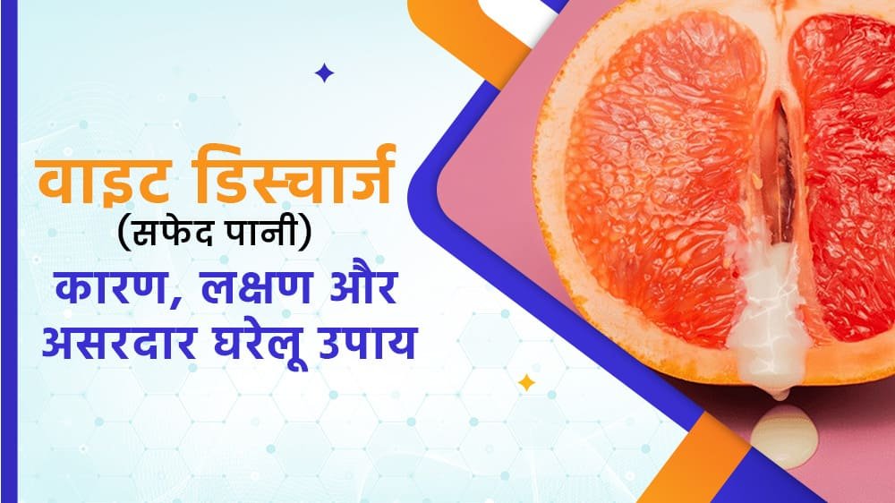 वाइट डिस्चार्ज