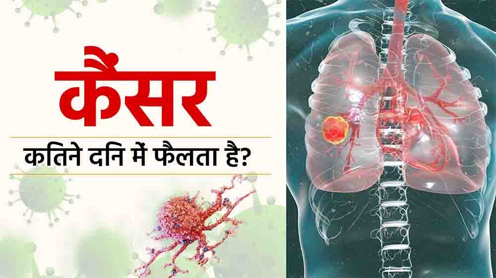 कैंसर कितने  दिन में फैलता है?