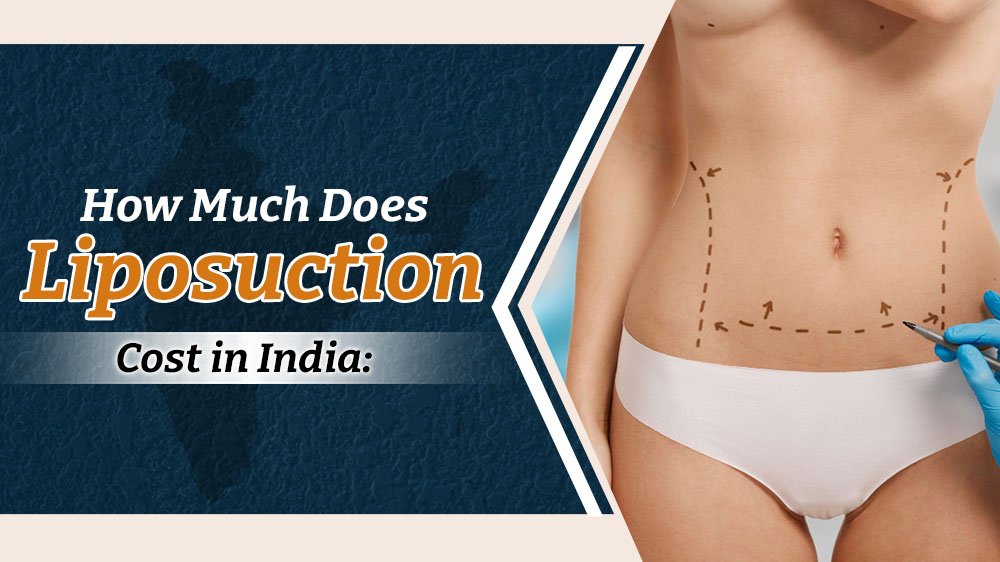  liposuction cost in India