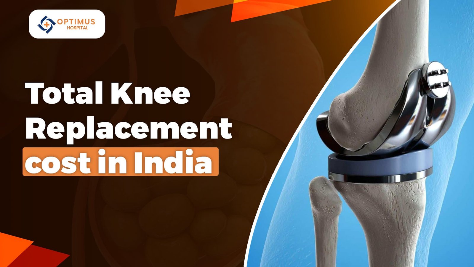 Total Knee Replacement Cost In India