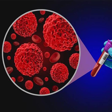 Biopsy & Cancer Diagnostics