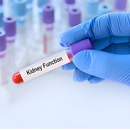 Kidney Function Tests (KFT)