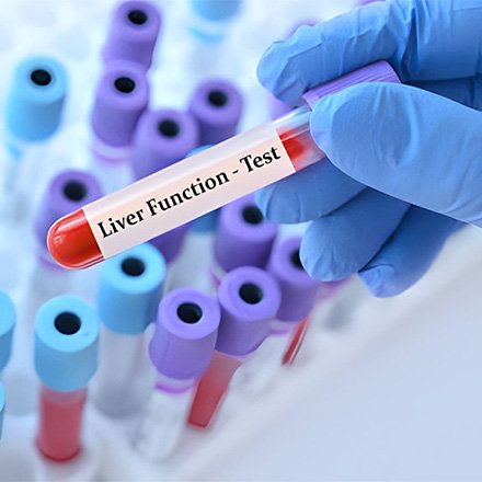 Liver Function Tests (LFT)