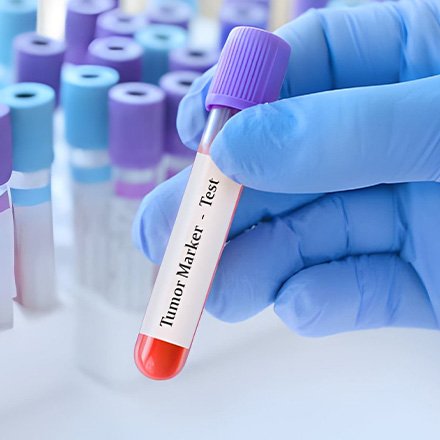 Tumor Markers