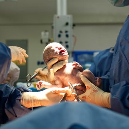 Cesarean Section