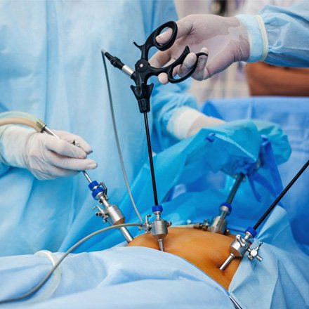 Laparoscopy Services