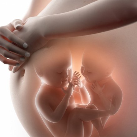Multiple Pregnancy Care