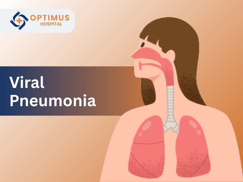 Illustration of human lungs showing symptoms of viral pneumonia – Optimus Hospital Gurgaon