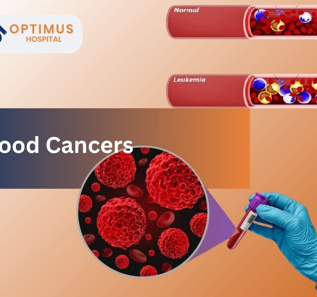 "Blood cancer illustration with normal and leukemia blood samples at Optimus Hospital in Gurgaon"