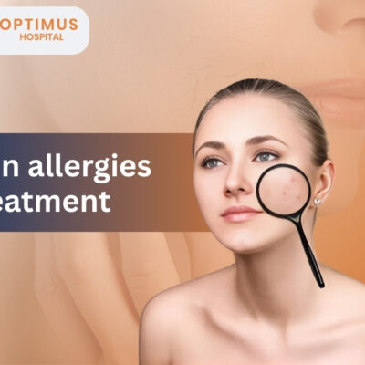 "Woman with healthy skin at Optimus Hospital illustrating skin allergies treatment in Gurgaon"