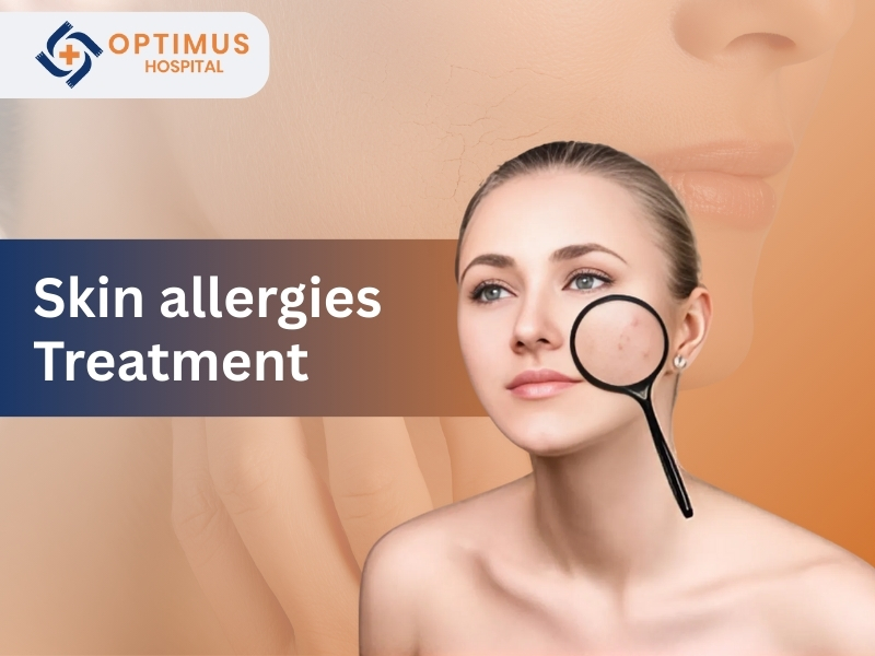 "Woman with healthy skin at Optimus Hospital illustrating skin allergies treatment in Gurgaon"